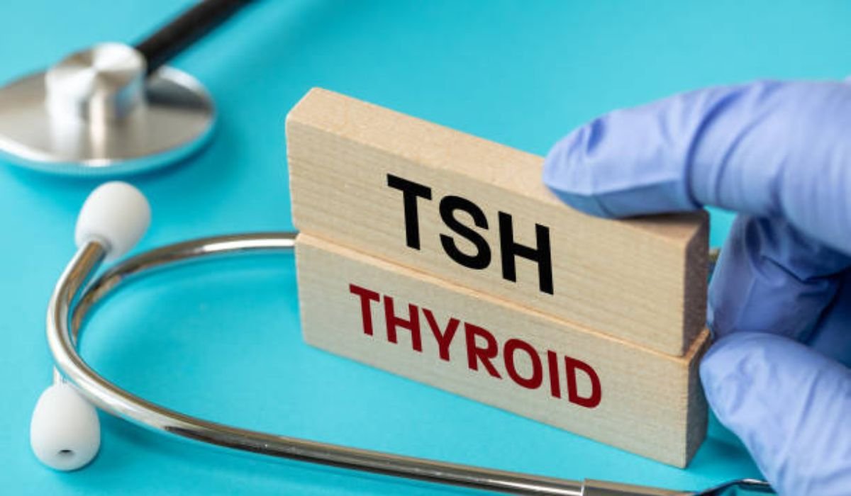 TSH with Reflex to FT4